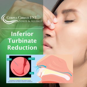 Inferior Turbinate Reduction