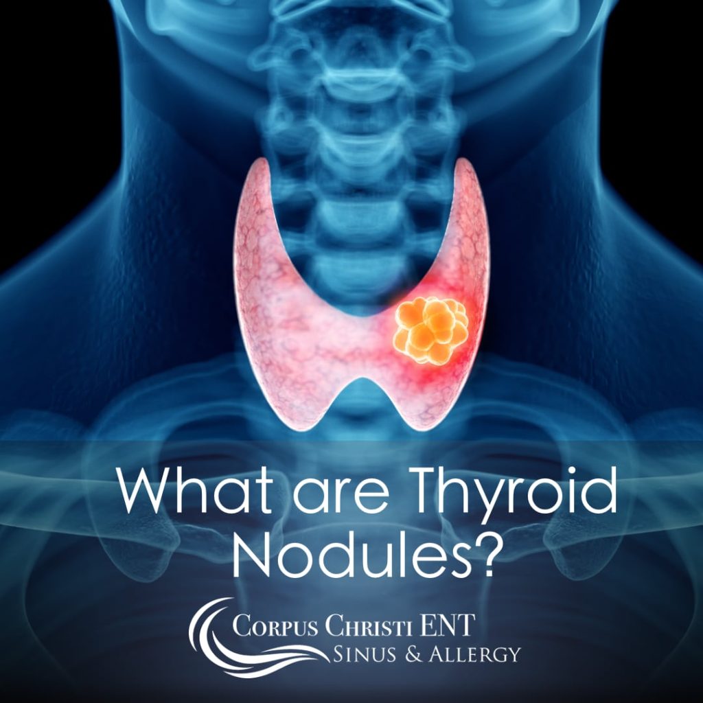 What are Thyroid Nodules? Corpus Christi ENT Sinus & Allergy