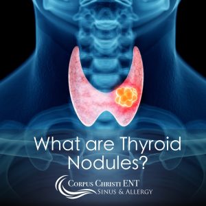 What are Thyroid Nodules?