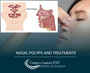 Nasal Polyps and Treatments